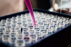 Services Diagnostic Lab Case Gallery 3 300x200 1