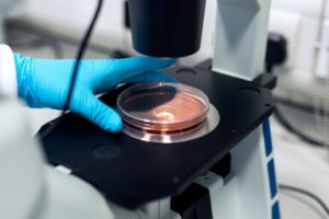 Services Diagnostic Lab Case Gallery 4 300x200 1